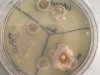 Pilze-Bakterien3